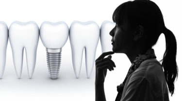 大分県でインプラントで失敗しないために