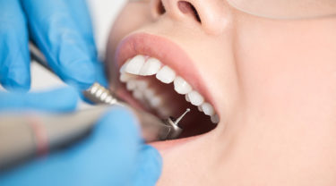 血友病患者と歯科治療